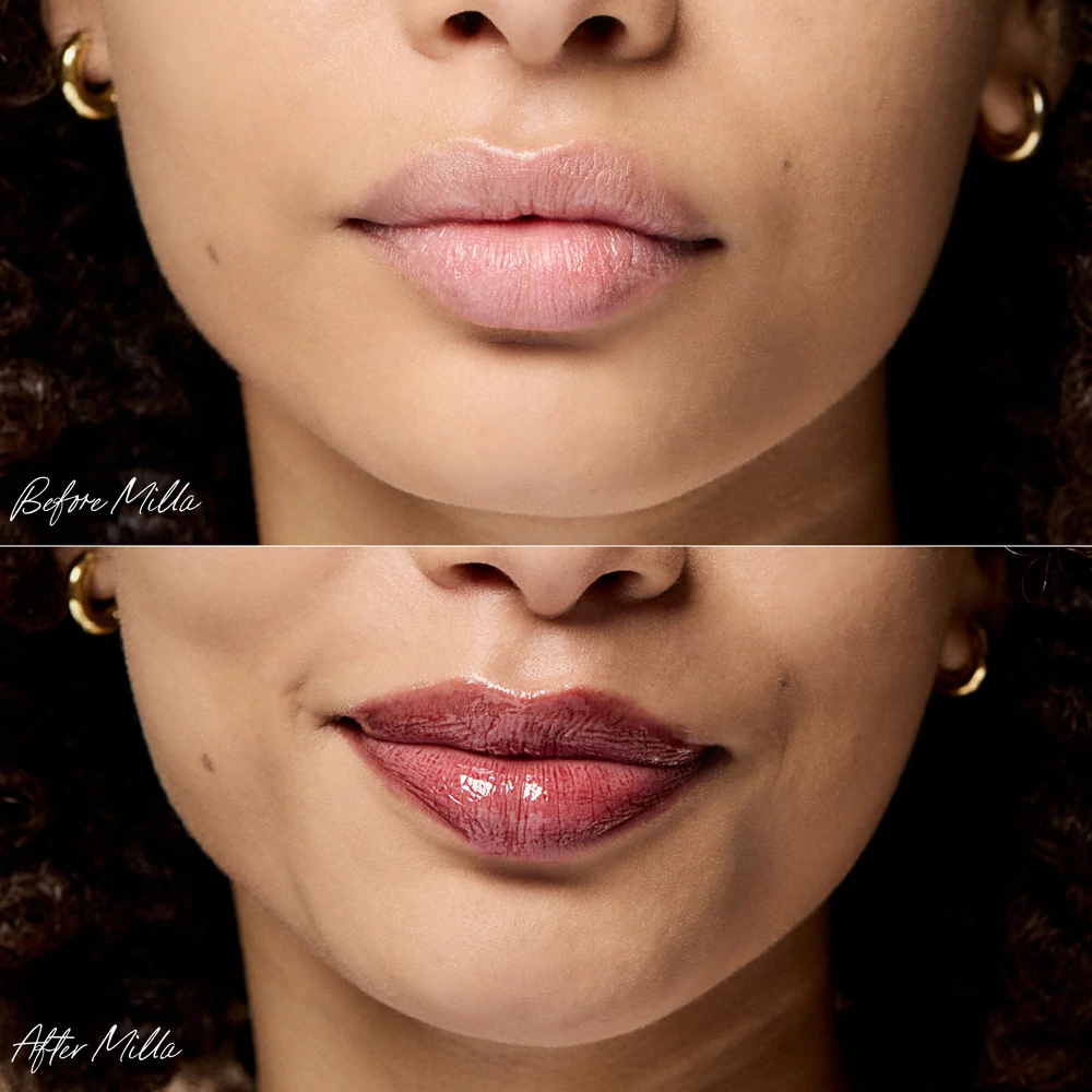 RMS legendary Szájfény és ajakápoló olajszérum - Milla