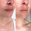 Kép 7/7 - EVOLVE RESVERATROL + NIACINAMIDE Bőrtökéletesítő arcápoló szérum hiperpigmentációra