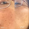 Kép 6/7 - EVOLVE RESVERATROL + NIACINAMIDE Bőrtökéletesítő arcápoló szérum hiperpigmentációra