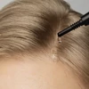 Kép 3/7 - MÁDARA SCALP - Fejbőr hámlasztó szérum