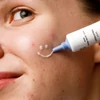 Kép 4/5 - MOSSA ACNE ACT Pattanáskezelő fluid