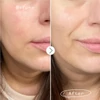 Kép 7/7 - PAI CALM IT Bőrnyugtató arcápoló szett érzékeny bőrre