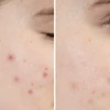 Kép 4/4 - PEM DELIAN Perfector pórusnormalizáló arctisztító gél