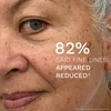 Kép 3/10 - REN BIO RETINOID Fiatalságmegőrző éjszakai arcolaj