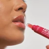 Kép 6/6 - NOVEXPERT LIP'UP AJAKDÚSÍTÓ KEZELÉS