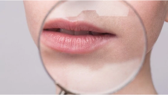 Ajakápolási tanácsok nyárra