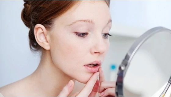 Miről árulkodnak a pattanások az arcodon?