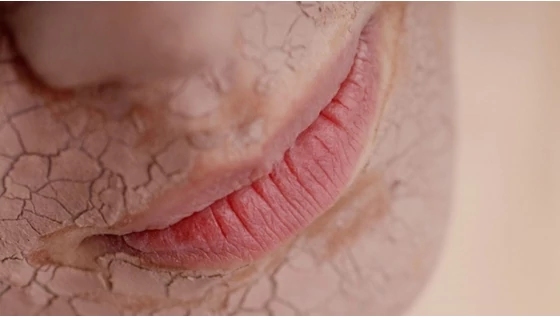 3 dolog, ami azonnal segítséget nyújt a száraz bőr ellen