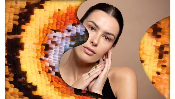 VISZLÁT PIGMENTFOLTOK!